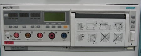 Phillips Series 50 XM Fetal Monitor