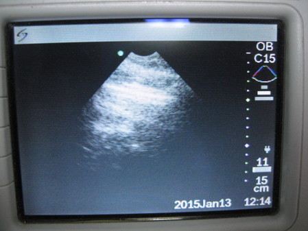 Sonosite 180 Plus Ultrasound System