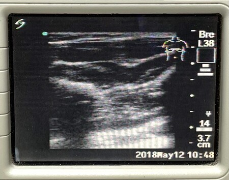 SonoSite L38 Linear Array Probe