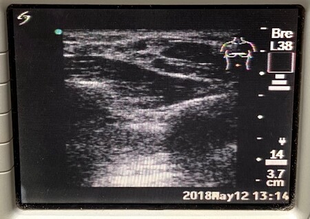 SonoSite L38 Transducer