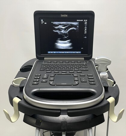 SonoSite Edge Ultrasound System