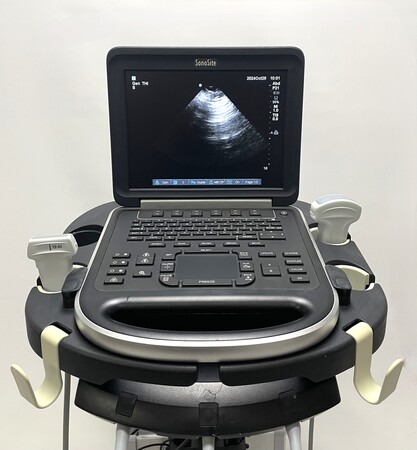 SonoSite Edge Ultrasound System