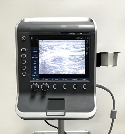  Sonosite S-Cath Ultrasound System