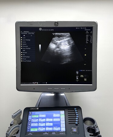 GE Logiq S8 Ultrasound System