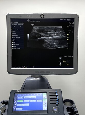 GE Logiq S8 Ultrasound System